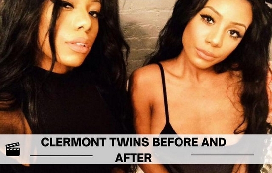 Clermont Twins Before After