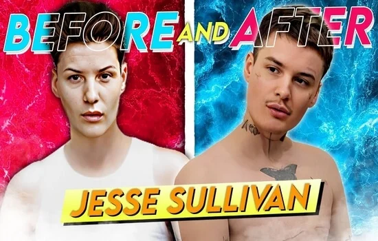 Jesse Sullivan Before and After